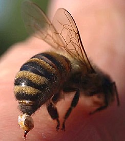 how to treat a bee sting